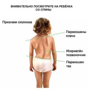 Пройти диагностику нарушения осанки у детей и получить рекомендации по лечению в Москве