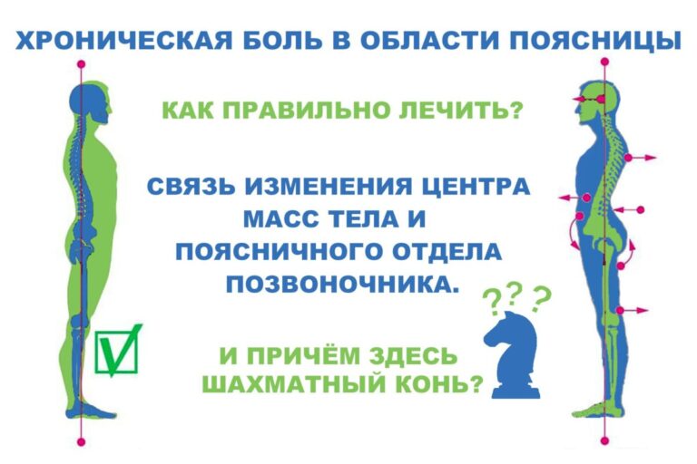 Хроническая боль в области поясницы? — как правильно лечить!