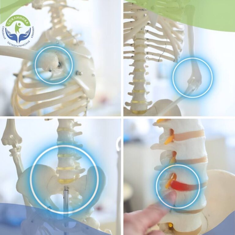 СОКЛИНИКА - Семейная Остеопатическая клиника 10 Вас мучает боль? Системно целостностный подход к диагностике и лечению с клинической Остеопатией вам помогут 🙌🏻