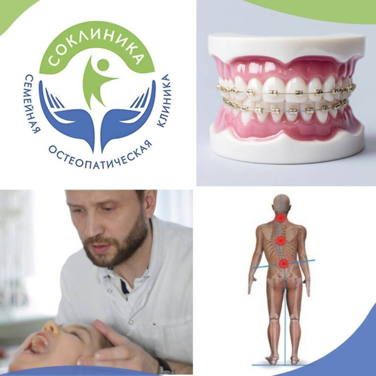 СОКЛИНИКА - Семейная Остеопатическая клиника 12 Как нарушение смыкания зубов или неправильный прикус связаны с Вашим телом?