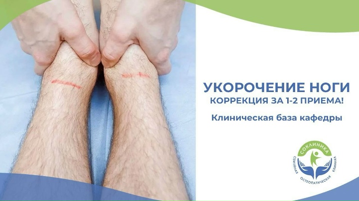 Укорочение ноги за 1-2 приема